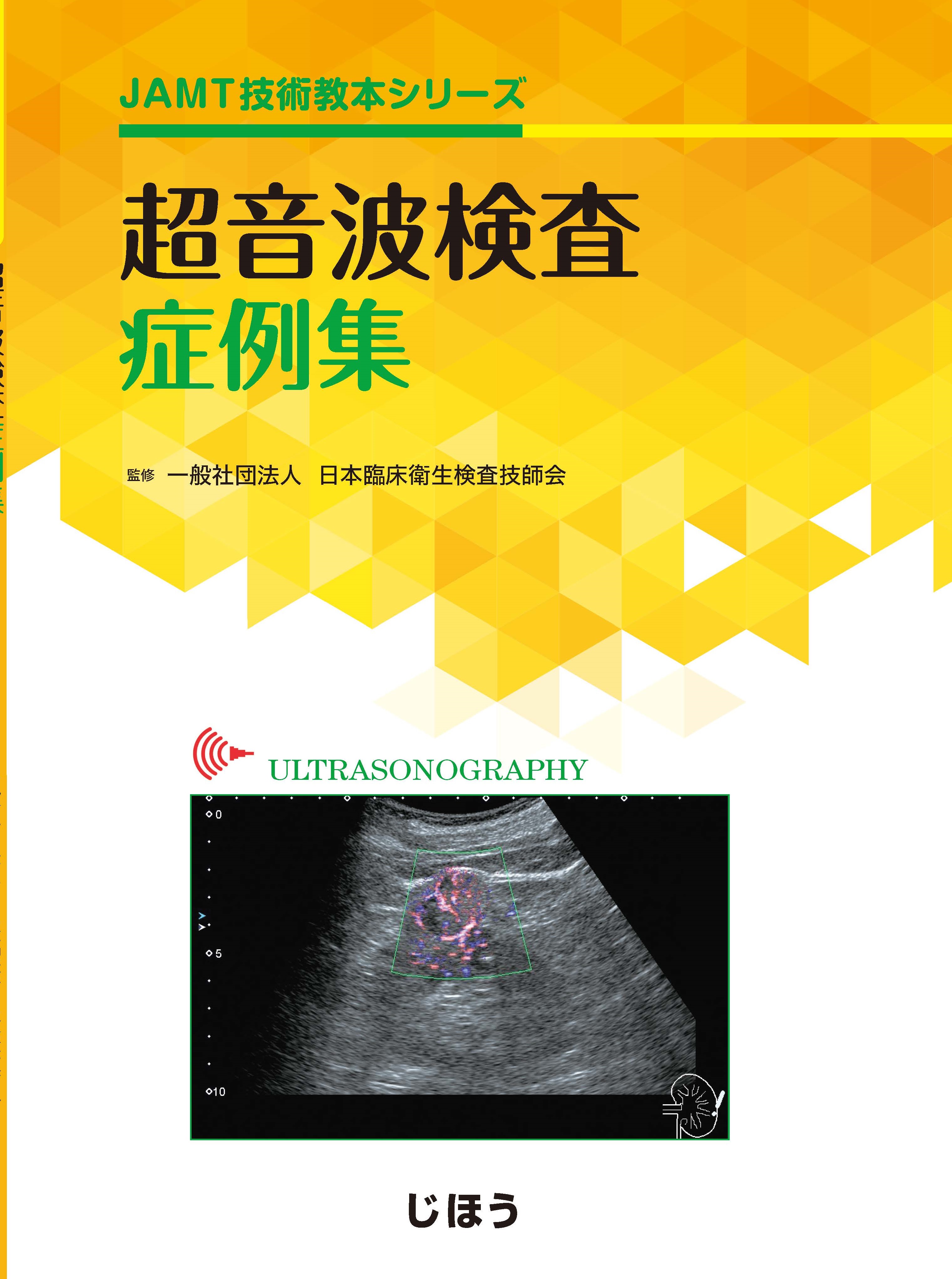 超音波検査症例集 | 出版物 | 一般社団法人 日本臨床衛生検査技師会